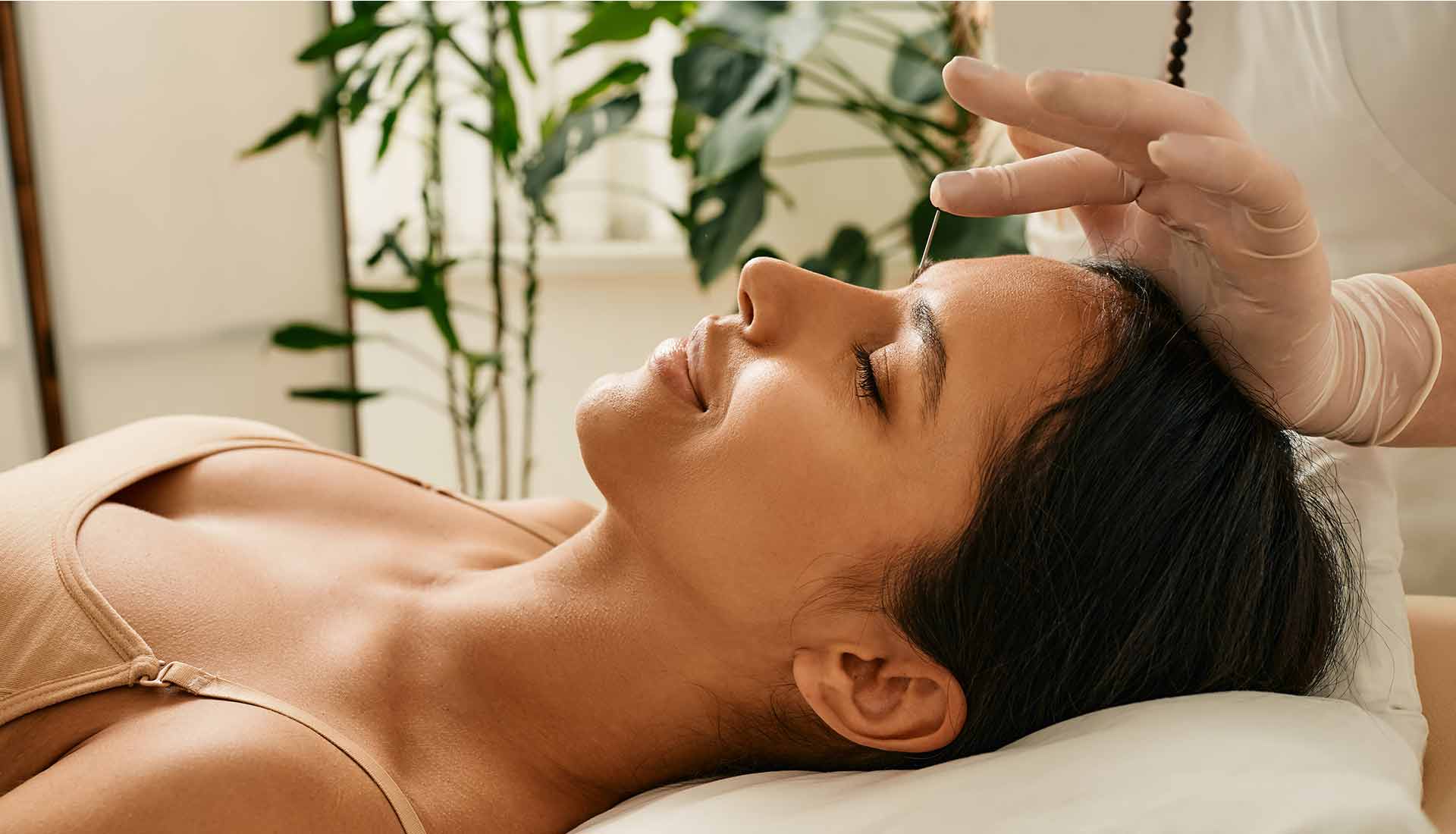 Acupuncture visage à Paris – soin Aculift, lifting naturel du visage